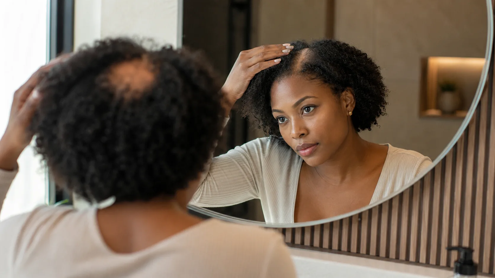 Central Centrifugal Cicatricial Alopecia (CCCA)